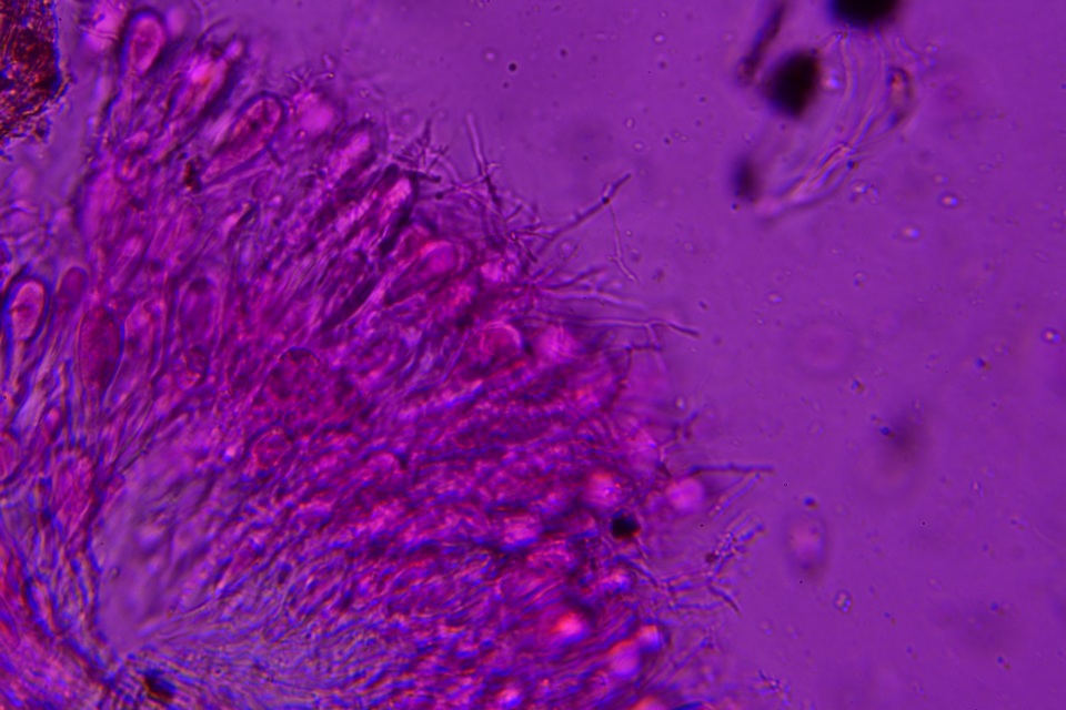 Exidiopsis galzinii image