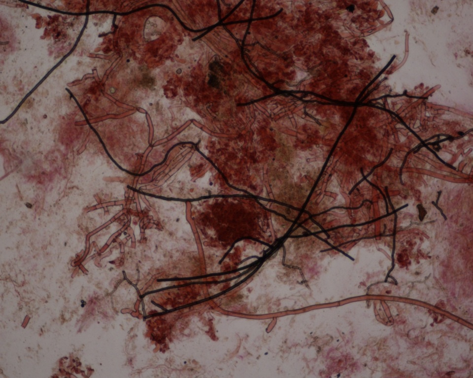 Botryobasidium rubiginosum image