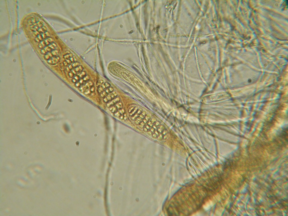 Triblidium caliciforme image