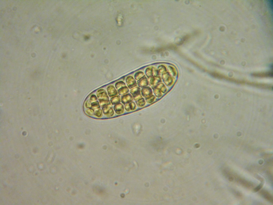 Triblidium caliciforme image
