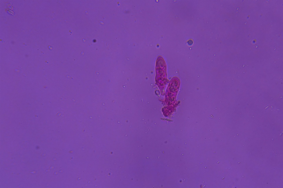 Gloeocystidiellum clavuligerum image