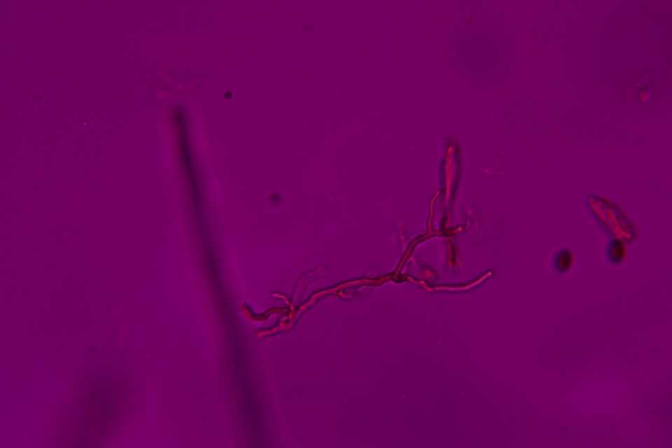 Fomitopsis durescens image