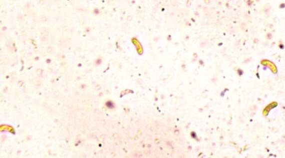 Ceriporia purpurea image