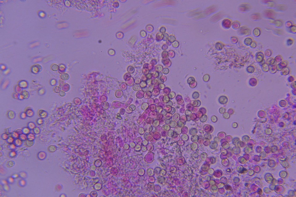 Dichostereum effuscatum image
