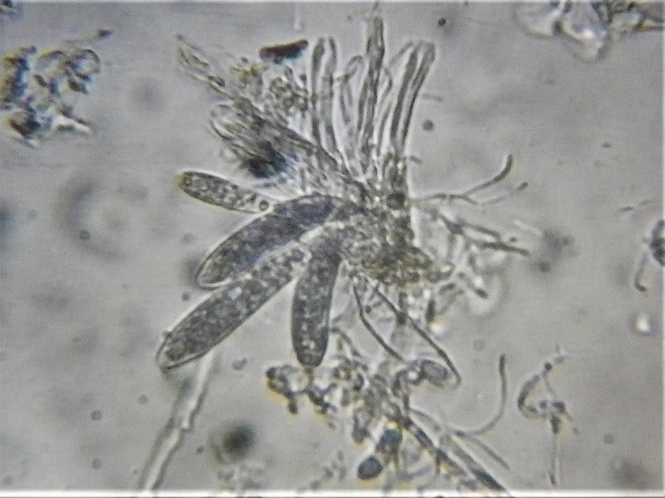 Pezicula cinnamomea image
