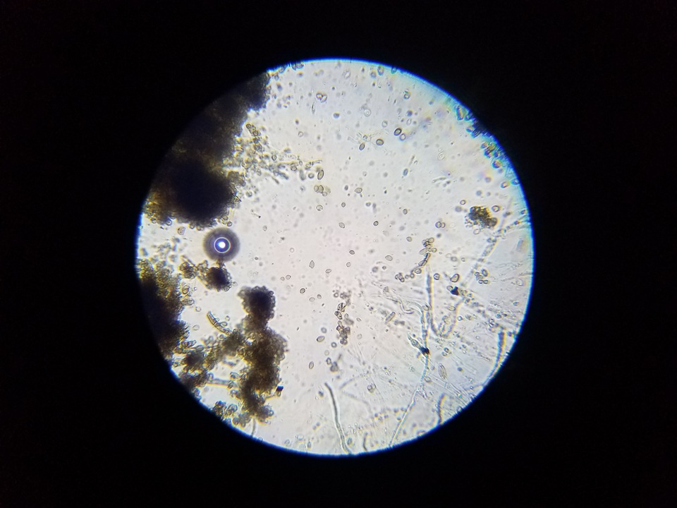 Cladosporium cladosporioides image