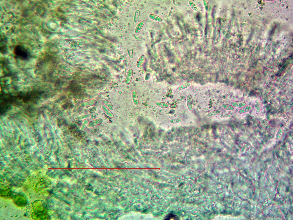 Lecanora albellula var. albellula image