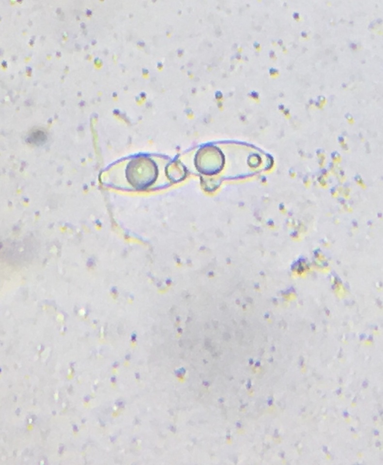 Gyromitra olympiana image
