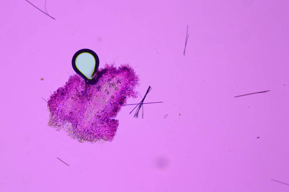 Hyphodontia curvispora image