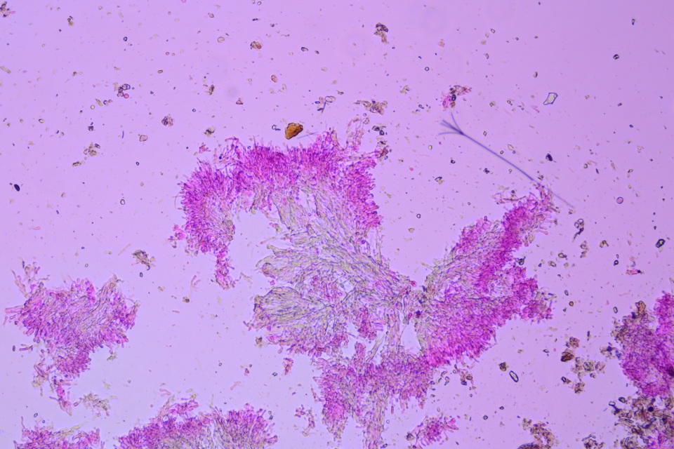 Hyphodontia curvispora image