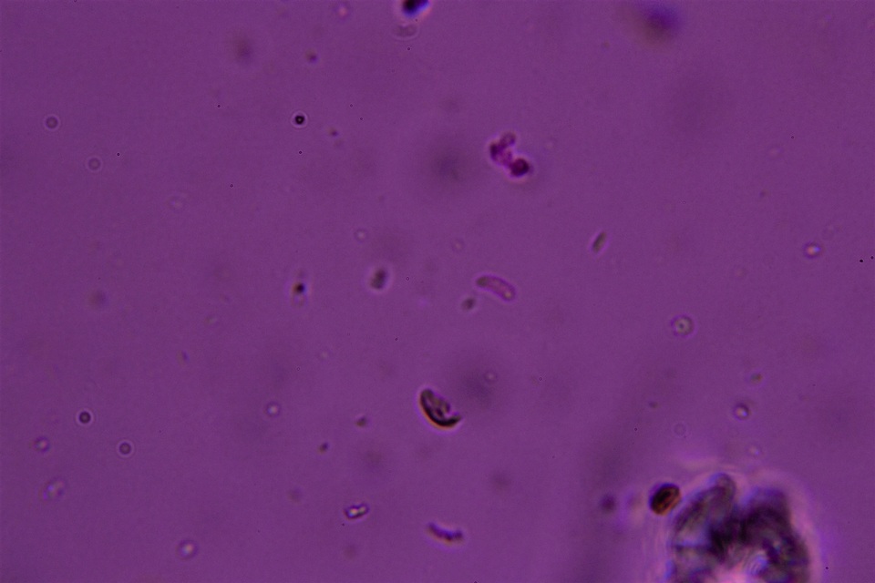 Hyphodontia curvispora image
