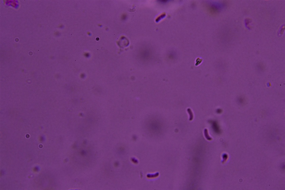Hyphodontia curvispora image