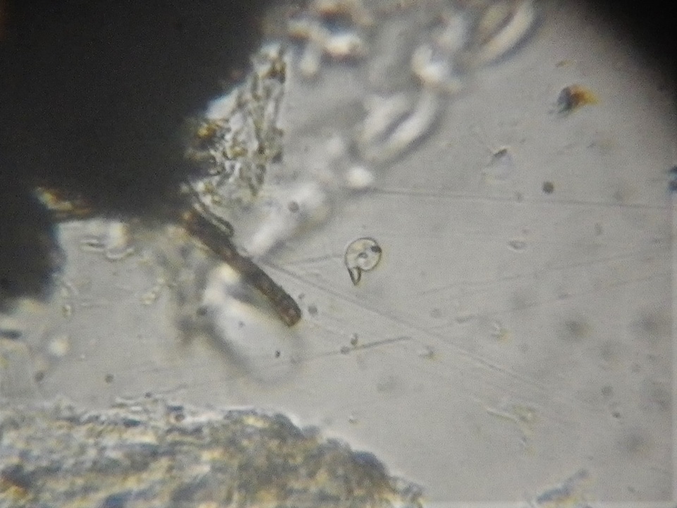 Thaxteriella pezizula image