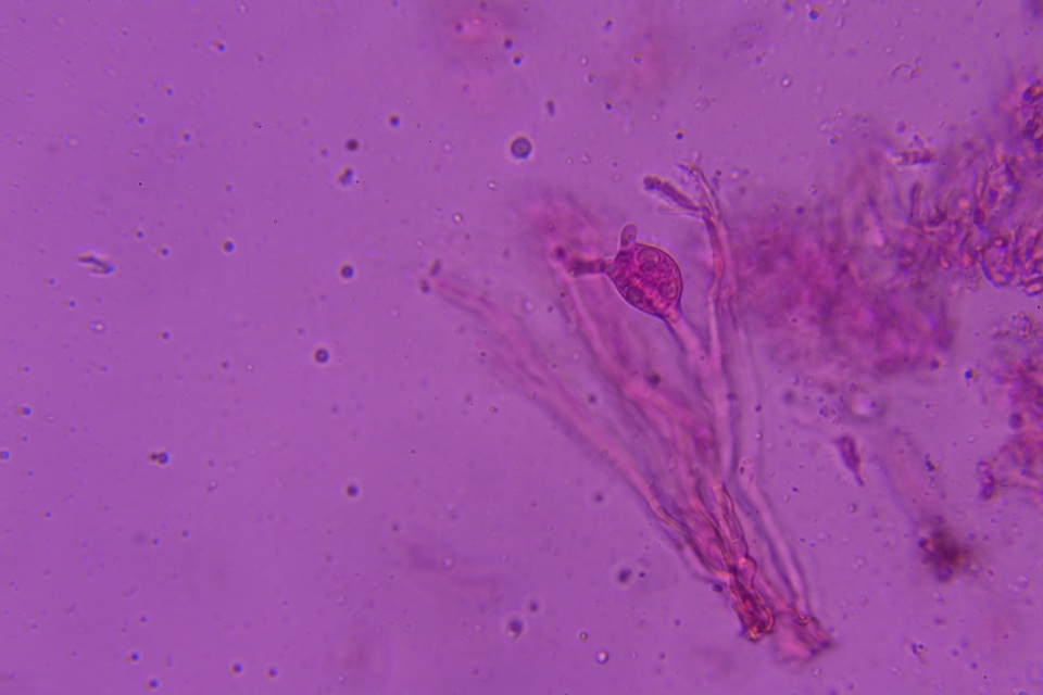 Sebacina epigaea image
