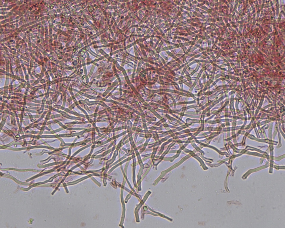 Stromatoscypha fimbriata image