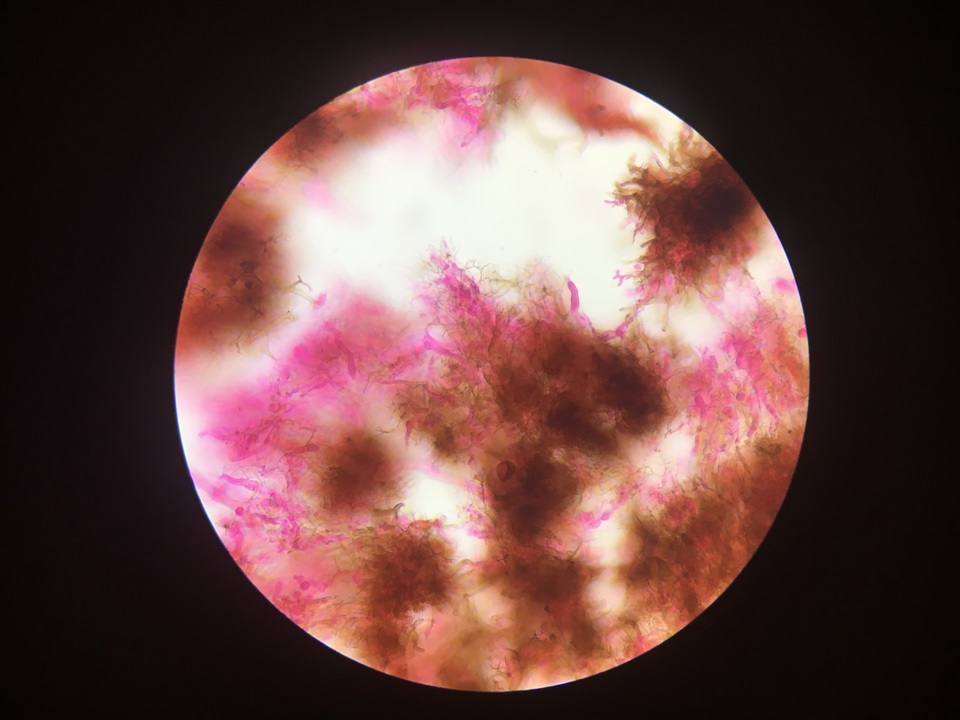Dichostereum sordulentum image