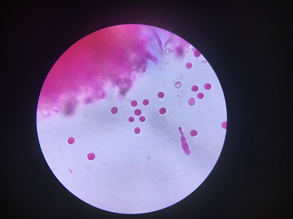 Dichostereum sordulentum image
