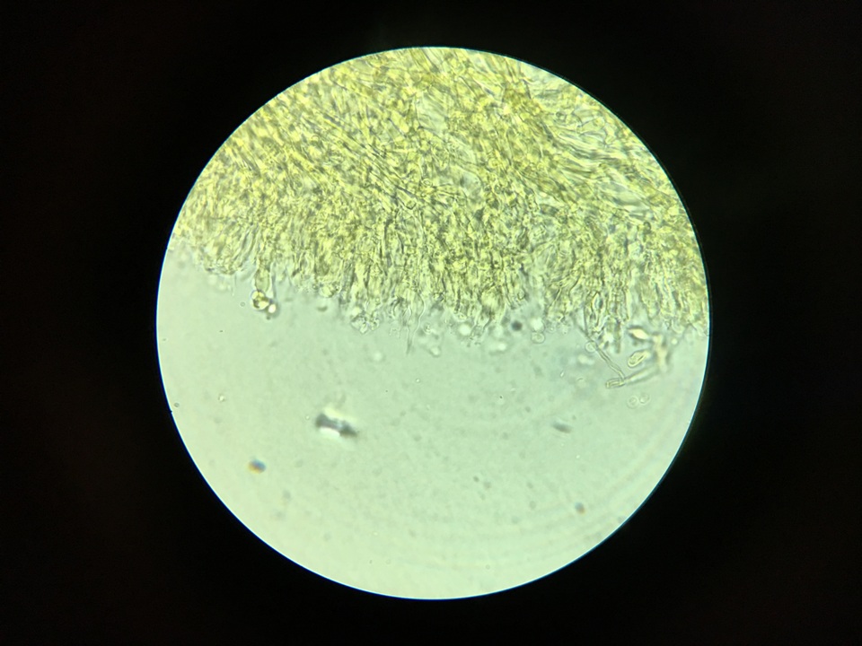 Hyphodontia subspathulata image