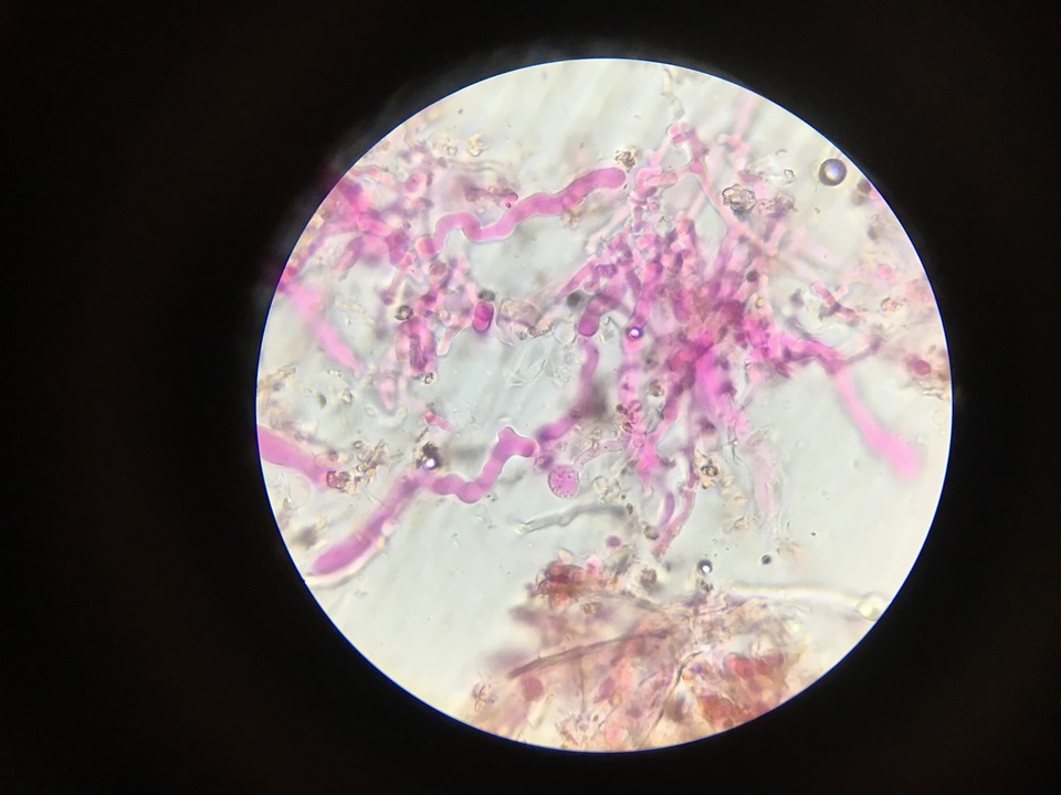 Corticium meridioroseum image