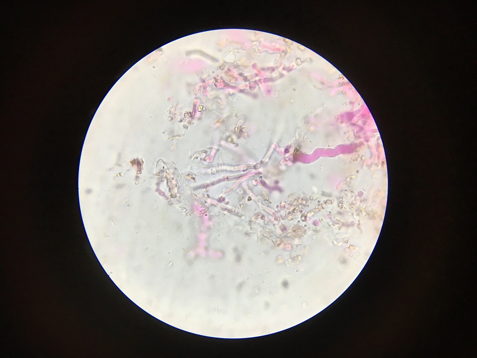 Corticium meridioroseum image