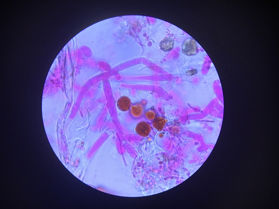 Botryobasidium vagum image
