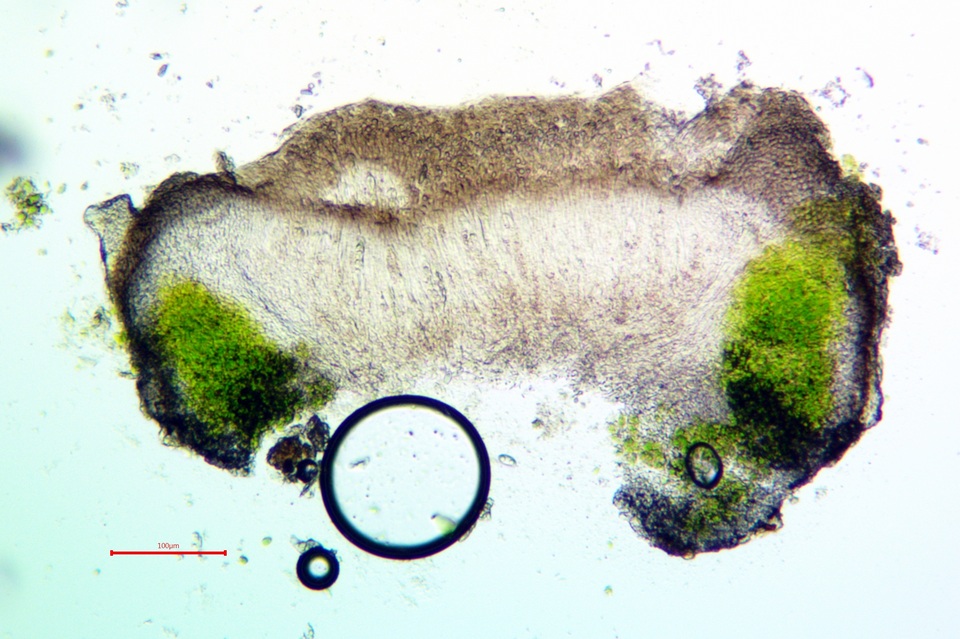 Caloplaca albovariegata image