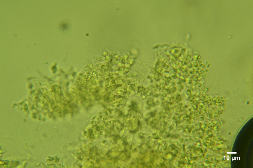 Sistotrema brinkmannii image