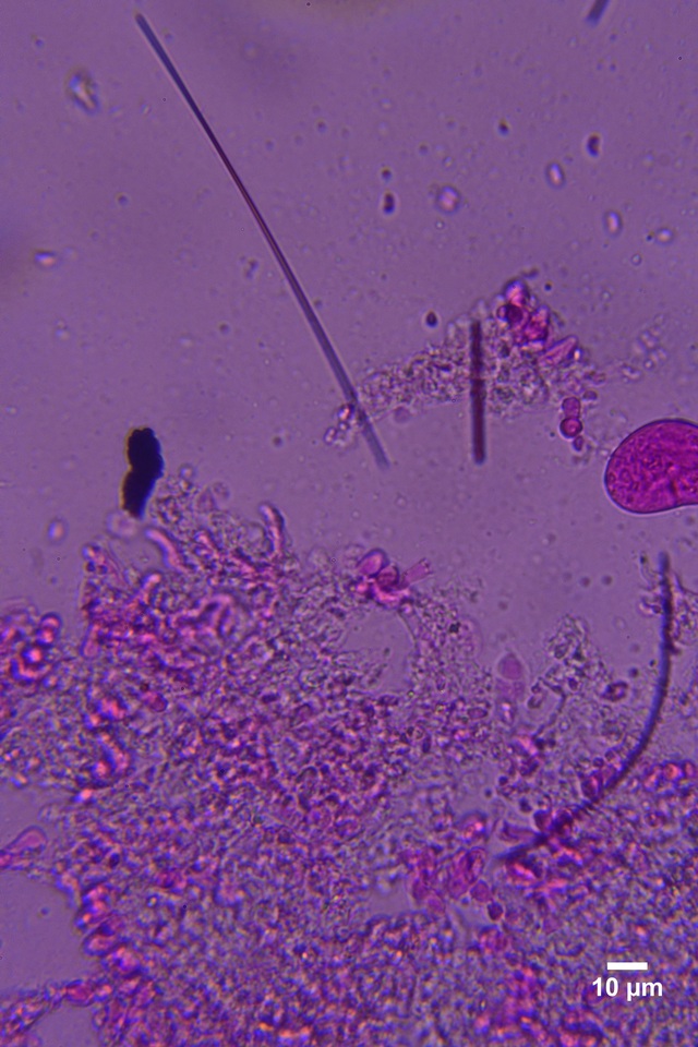 Sistotrema brinkmannii image