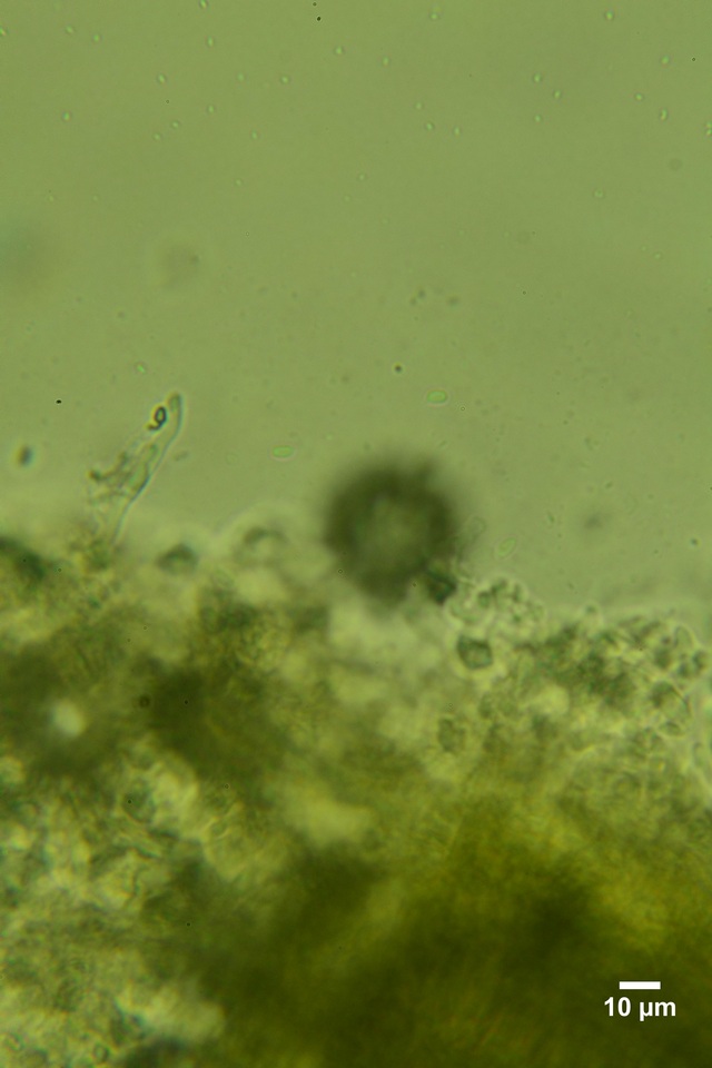 Sistotrema octosporum image