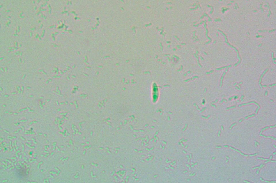 Micarea denigrata image