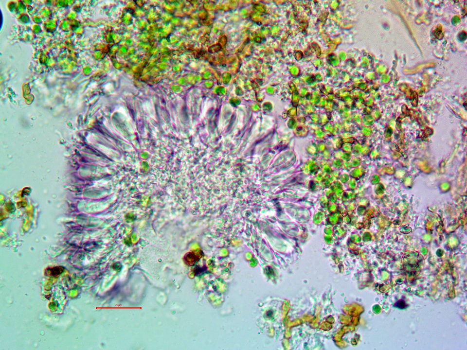 Micarea nitschkeana image