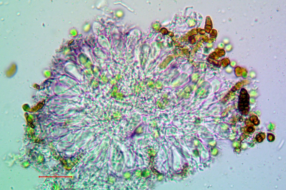 Micarea nitschkeana image