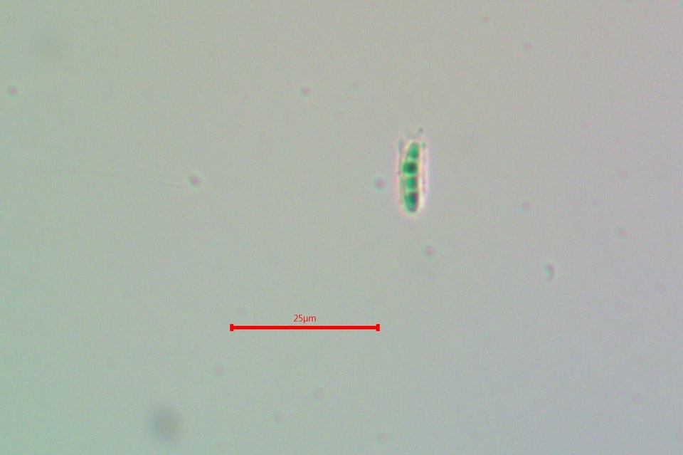 Micarea nitschkeana image