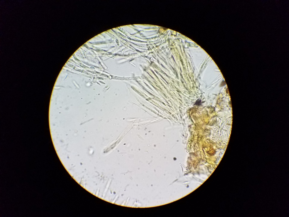 Lachnellula cervina image