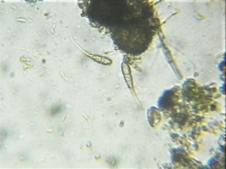 Rebentischia image