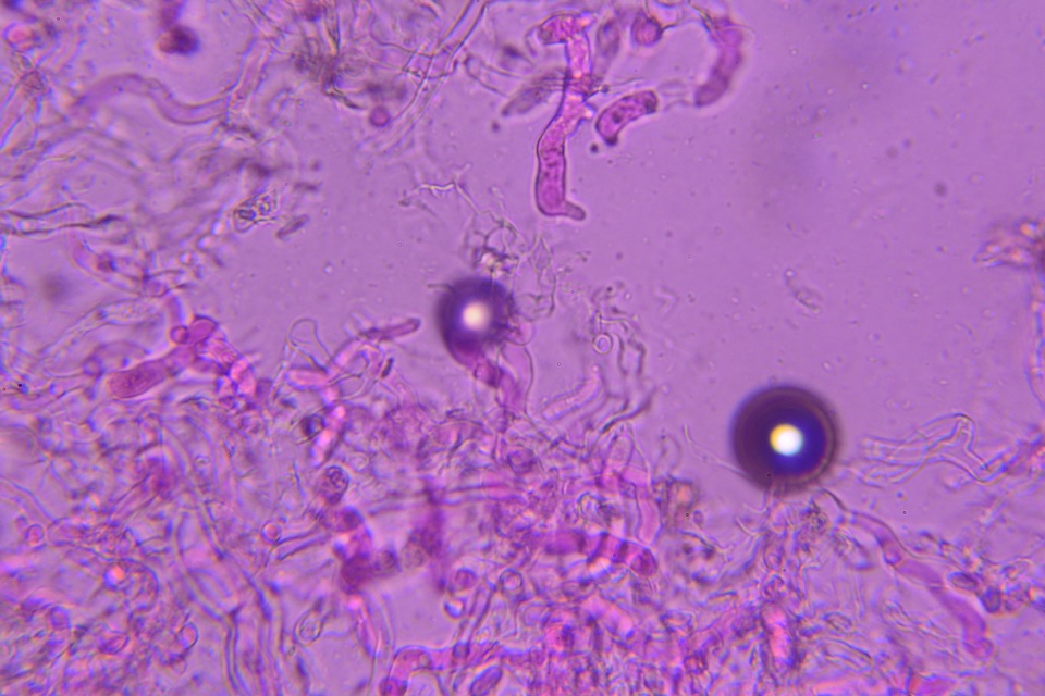 Eocronartium image