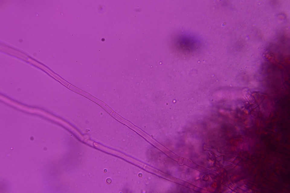 Thelephora scissilis image