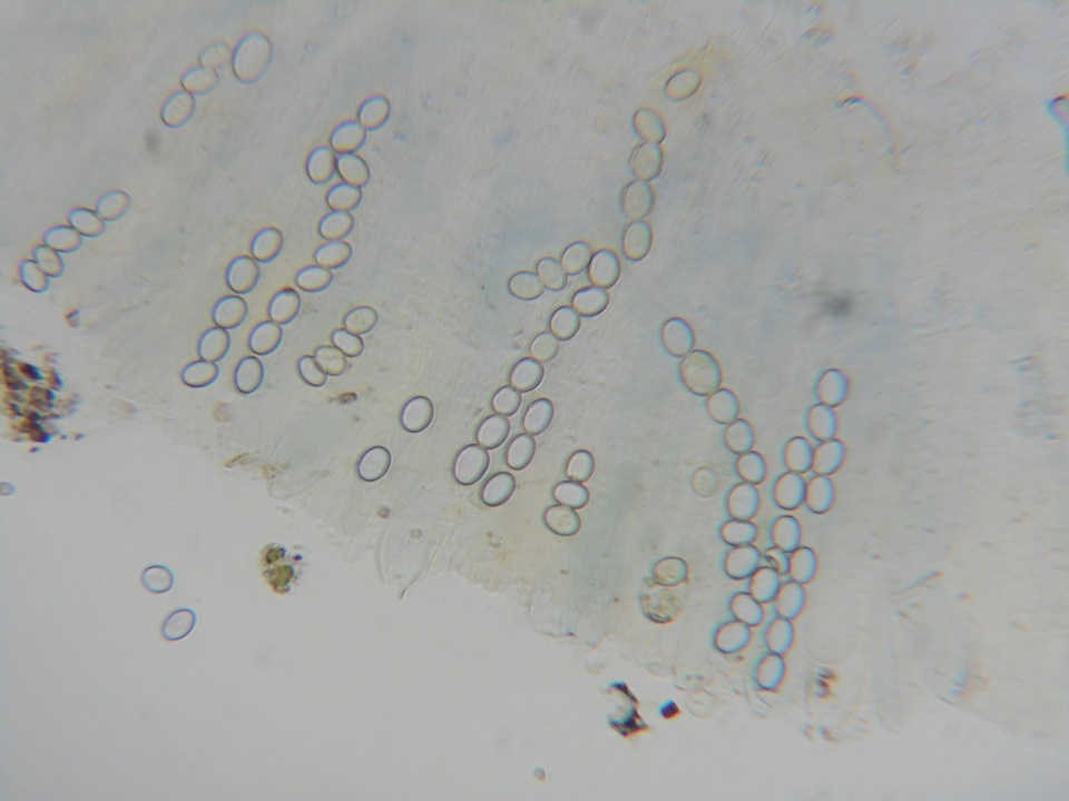 Pachyella babingtonii image
