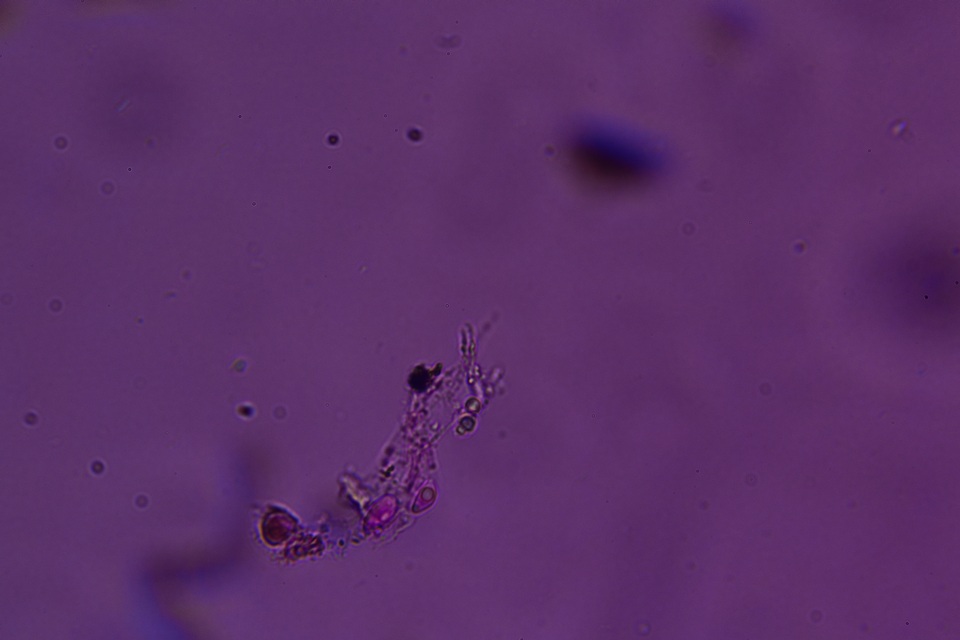 Flagelloscypha minutissima image