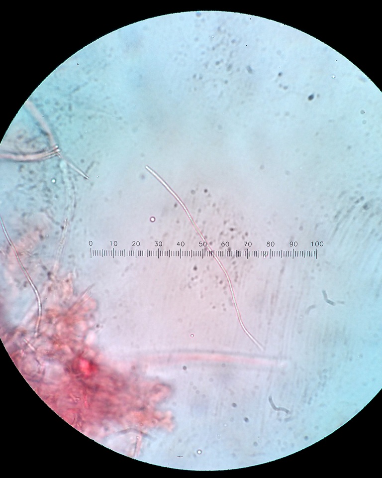 Balansiopsis gaduae image