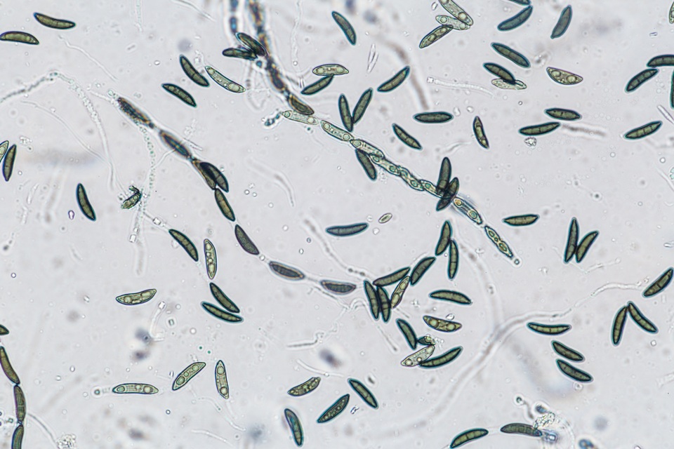 Xylaria cornu-damae image