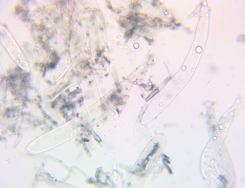 Geoglossum alveolatum image