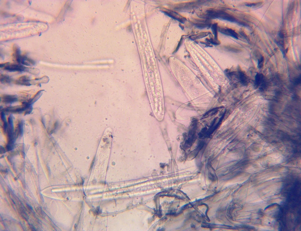 Geoglossum alveolatum image