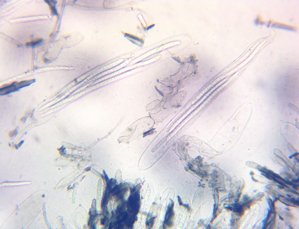 Geoglossum alveolatum image