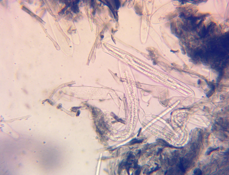 Geoglossum alveolatum image