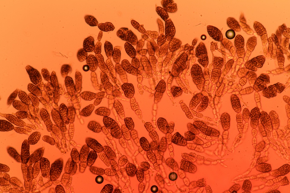 Berkleasmium conglobatum image