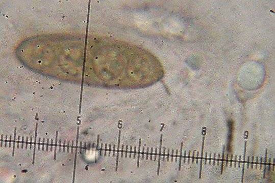 Pyrenula caryae image