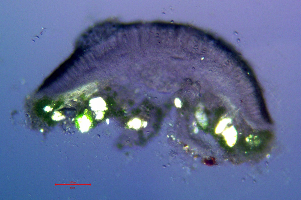 Lecanora meridionalis image