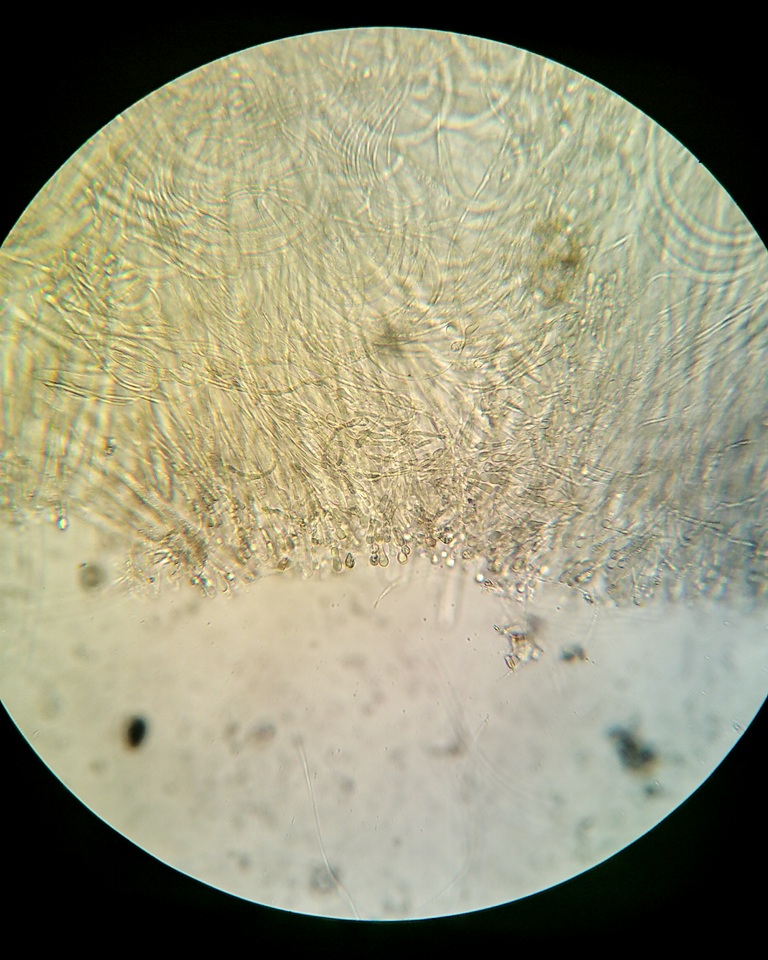 Vibrissea filisporia image