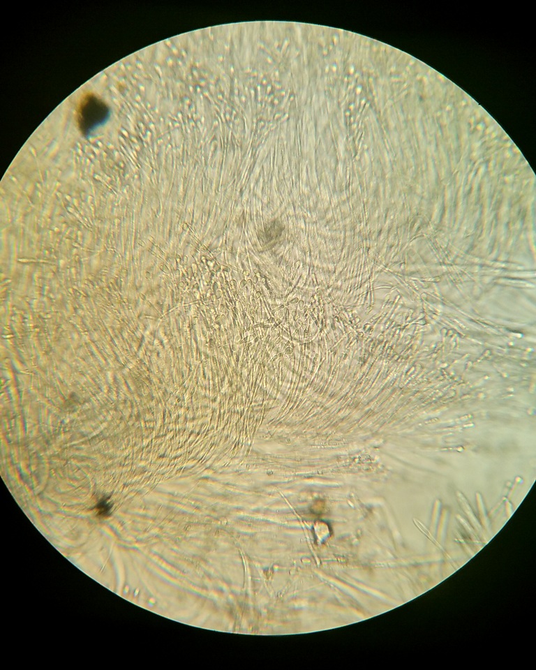 Vibrissea filisporia image